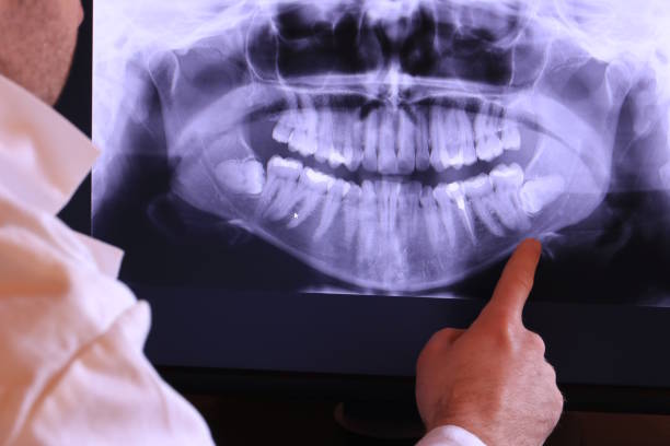 Best Broken or Cracked Tooth Emergency Dentist in Kaufman, TX