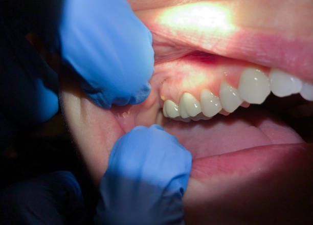 Best Orthodontic Emergency Dentist in Kaufman, TX