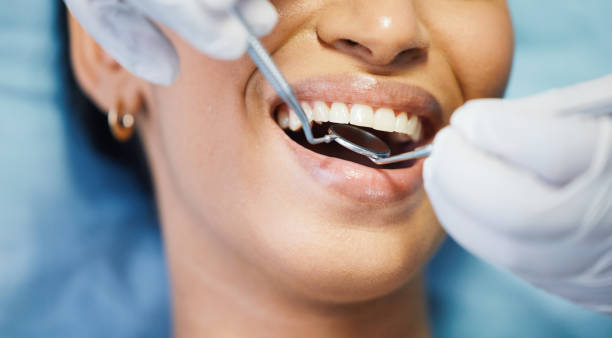 Best Emergency Dental Services for Seniors in Kaufman, TX