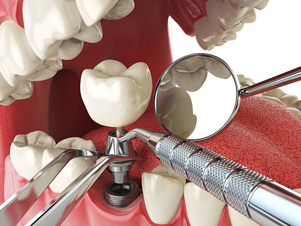 Best Emergency Dentist for Special Needs Patients in Kaufman, TX